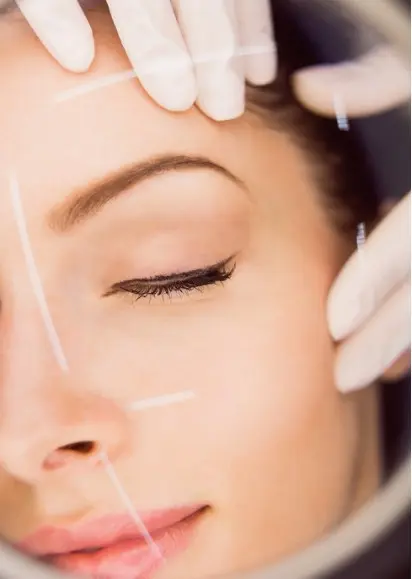 Fibroblast (Plasma Pen) en Madrid